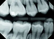 Midmark Preva™ DC Intraoral X-Ray
