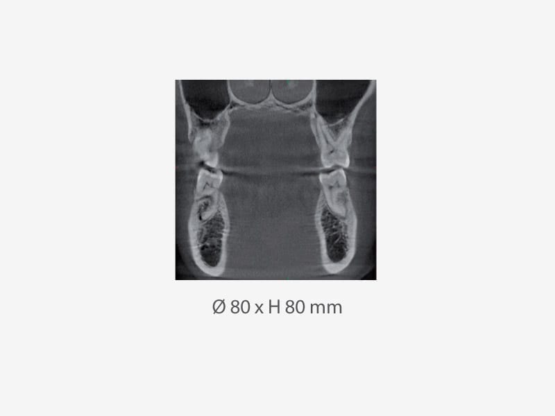 Morita Veraviewepocs 3D R100