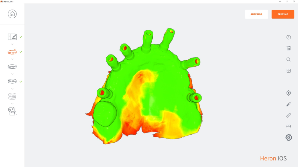 3Disc OVO Impression Scanner with Computer